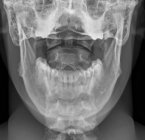 Articolazione tra cranio e collo — Foto stock