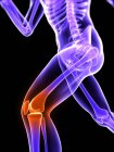 Біль локалізований в колінному суглобі — стокове фото