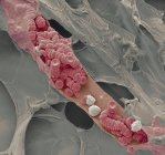 Venule rotte che attraversano il tessuto adiposo — Foto stock