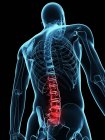 Localisation of back pain in spinal section — Stock Photo