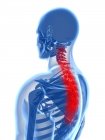 Localización del dolor de espalda en la sección espinal - foto de stock