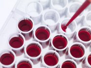 Muestras de sangre en tubos de ensayo - foto de stock
