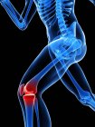 Біль локалізований в колінному суглобі — стокове фото
