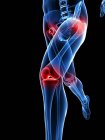 Schmerzen im Kniegelenk lokalisiert — Stockfoto