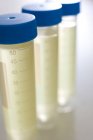 Gros plan des tubes d'échantillonnage avec des échantillons médicaux . — Photo de stock