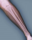 Кольоровий рентгенівський знімок нижньої ноги 24-річної жінки . — стокове фото