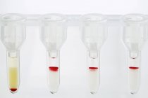 Nahaufnahme von Behältern für Blutgruppentests. — Stockfoto