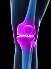 Knee joint with localized focus of inflammation — Stock Photo