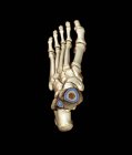 Tomodensitométrie 3D colorée (TDM) du pied sain d'un patient de 23 ans . — Photo de stock