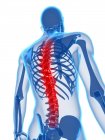 Localisation of back pain in spinal section — Stock Photo