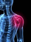 Localização da dor na articulação do ombro — Fotografia de Stock