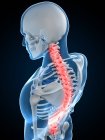 Pain in cervical section of spine — Stock Photo