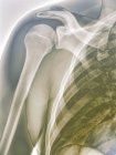 Anatomia strutturale della spalla normale — Foto stock
