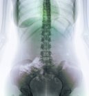 Anatomía normal y saludable del abdomen - foto de stock