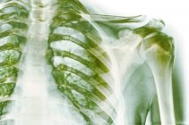 Anatomie structurelle de l'épaule normale — Photo de stock