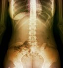 Anatomia do abdômen normal e saudável — Fotografia de Stock