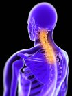 Dolore nella sezione cervicale della colonna vertebrale — Foto stock