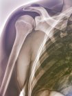 Структурная анатомия нормального плеча — стоковое фото