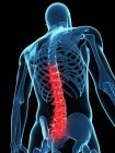 Локализация болей в спине в позвоночнике — стоковое фото