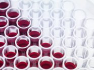 Échantillons de sang prêts pour l'analyse — Photo de stock