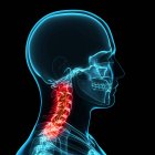 Dor no pescoço que afeta as vértebras cervicais — Fotografia de Stock