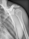 Structural anatomy of normal shoulder — Stock Photo