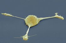 Cellula fibroblastica, micrografo elettronico a scansione colorata (SEM ). — Foto stock