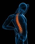 Localisation des maux de dos dans la colonne vertébrale — Photo de stock