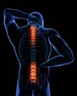 Localização da dor nas costas na secção espinhal — Fotografia de Stock