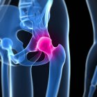 Painful sensation in hip joint — Stock Photo