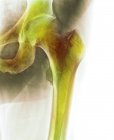 Здоровый тазобедренный сустав — стоковое фото