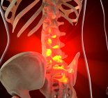 Pain localized in lumbar section of spine — Stock Photo