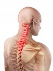 Schmerzen im Halswirbelsäulenbereich — Stockfoto