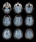 Imagerie par résonance magnétique colorée scans du cerveau sain du patient
. — Photo de stock