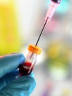 Investigador que extrae sangre de un vial - foto de stock