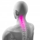 Back pain localized in spine — Stock Photo