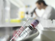 Close-up de tubo e seringa em laboratório de hematologia com cientista em segundo plano . — Fotografia de Stock
