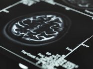 Serie von MRI-Gehirnscans — Stockfoto