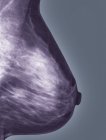 Normal mammogram of the left breast — Stock Photo