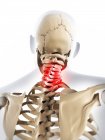 Pain localized in cervical region of spine — Stock Photo