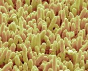 Electron micrograph of dental plaque — Stock Photo