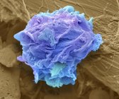 Раковые клетки лимфомы — стоковое фото