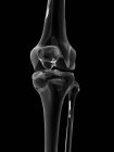 Struttura articolare del ginocchio — Foto stock