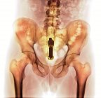 Foreign object in rectum — Stock Photo