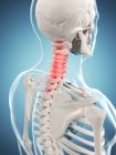 Dolore localizzato nella regione cervicale della colonna vertebrale — Foto stock