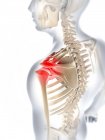 Shoulder joint pain and discomfort — Stock Photo
