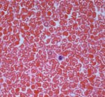 Light micrograph of red blood cells (erythrocytes, red) in a blood vessel. — Stock Photo