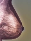 Radiographie colorée du sein gauche (mammographie) d'un patient de 27 ans . — Photo de stock