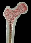 Нормальна верхня права кістка стегнової кістки — стокове фото