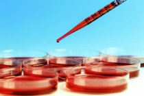 Pipette and petri dishes for blood testing. — Stock Photo
